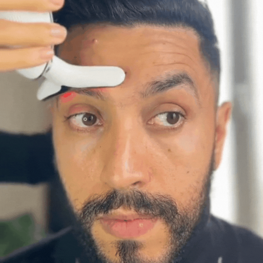 LIFTEE Sonic EMS – na Obwisłe Policzki i Zmarszczki