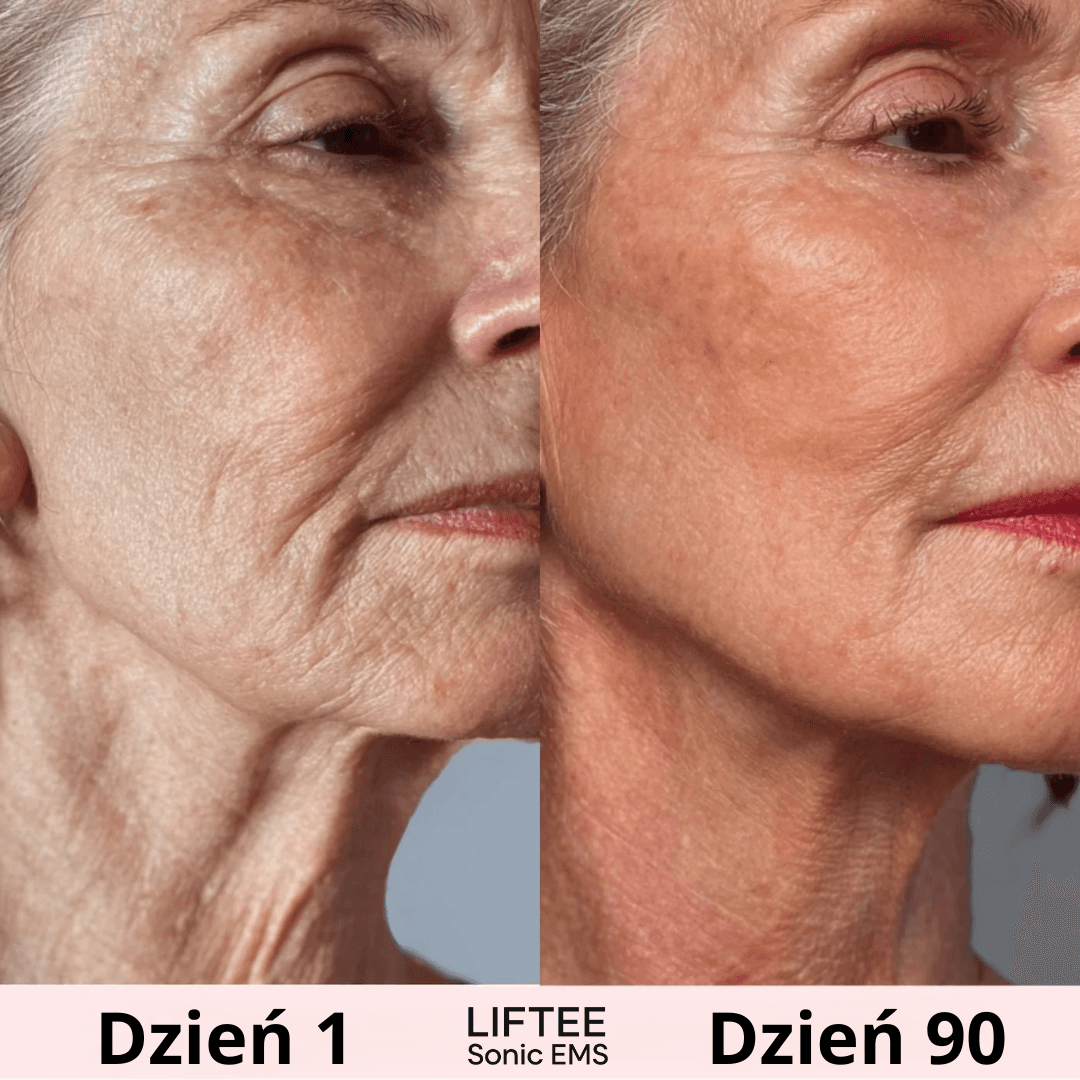 LIFTEE™ – codzienna rutyna, która napina policzki i wygładza zmarszczki
