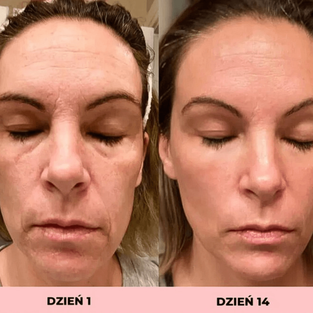 LIFTEE Sonic EMS – na Obwisłe Policzki i Zmarszczki