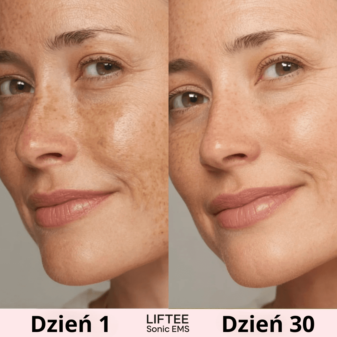 LIFTEE™ – codzienna rutyna, która napina policzki i wygładza zmarszczki