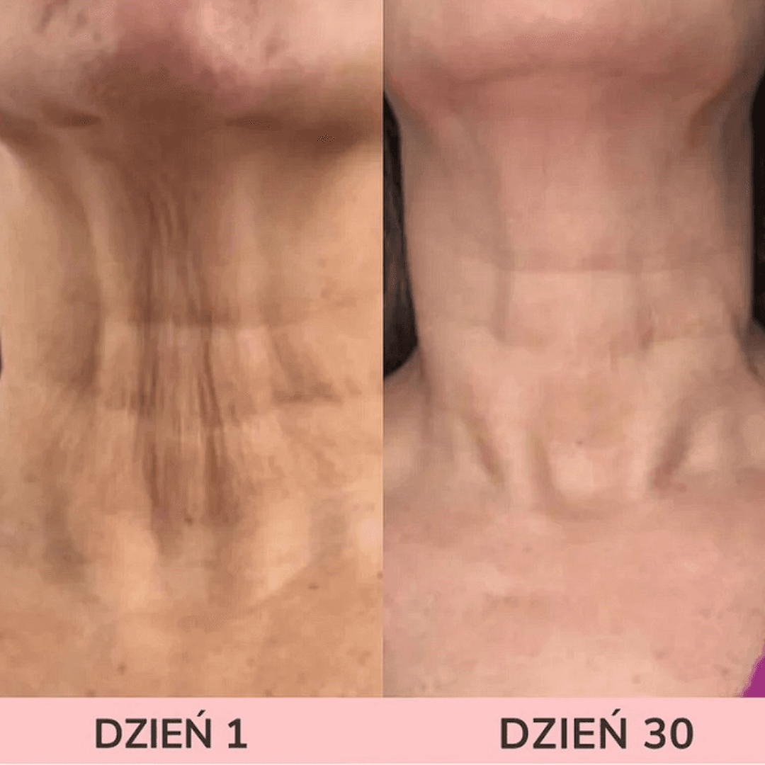 LIFTEE Sonic EMS – na Obwisłe Policzki i Zmarszczki