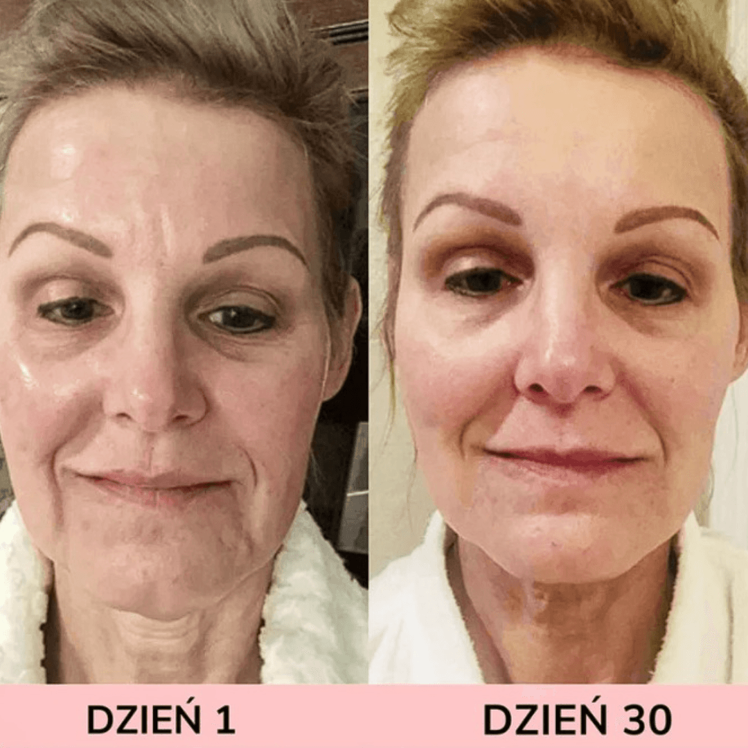 LIFTEE Sonic EMS – na Obwisłe Policzki i Zmarszczki